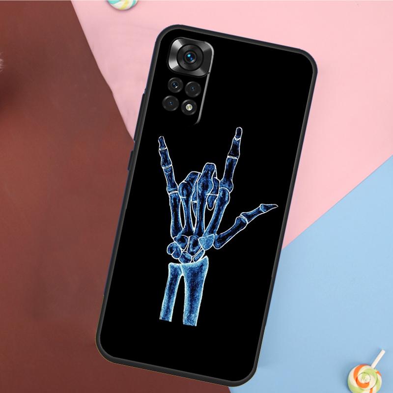Surfer Surf Hang Loose Cover For Xiaomi Redmi Note 14 13 Pro 12 11 9 10 9S 10S 11S 12S Redmi 14C 10C 12C 13C Case