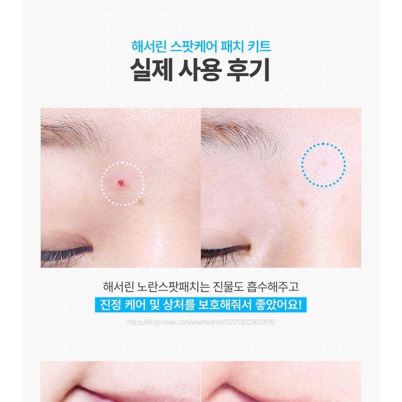 HATHERINE - Spot Care Patch Kit