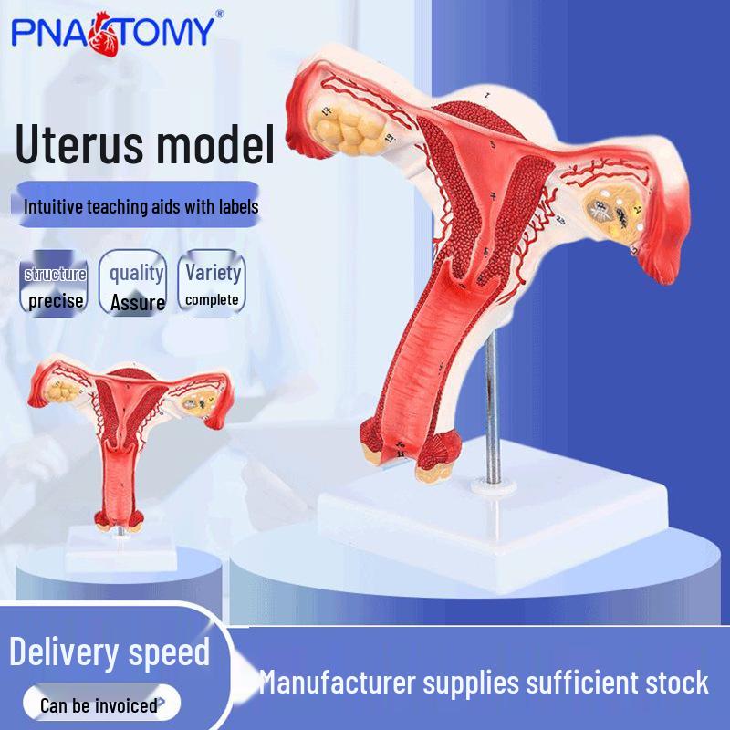 Human Uterus and Ovary Anatomy Model for Female Education and Family Planning 20*17.5*9 cm