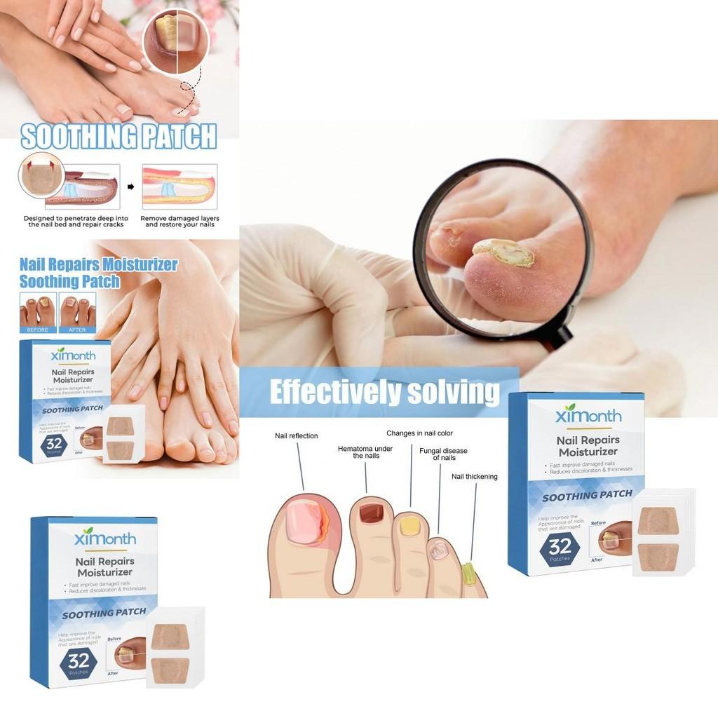 Ximonth Nagelreparatur-Pflaster Weiches Gel Verdickende Nagelpflege Zur Behandlung von Pilzinfektionen