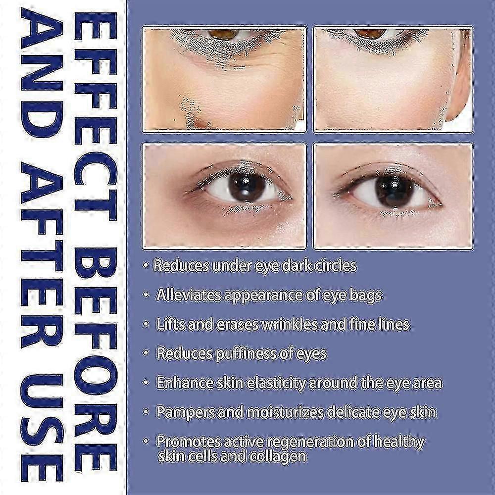 Jaysuing Active Eye Cream - Anti-wrinkle, Circle Removal, And Eye Bag Reduction