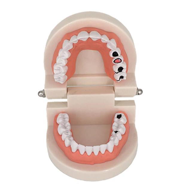 Early Childhood Education Brushing Model Oral Teaching Tooth Model Large Simulation Tooth Model Montessori Teaching Tool