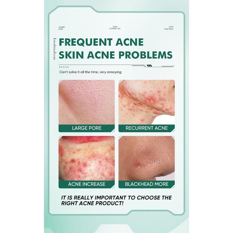 1 BALENÍ Gel s kyselinou salicylovou a azelaovou vybledne jizvy po akné, zmenšuje póry, odstraňuje akné a uzavírá ceramidové mléčné kyselinové akné krém