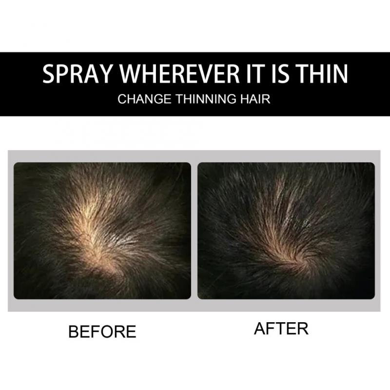 EELHOE Dense Hair Fiber Powder Hair Increase, Hair Volume Fiber Thickness, Hair Powder and Plant Fiber Powder