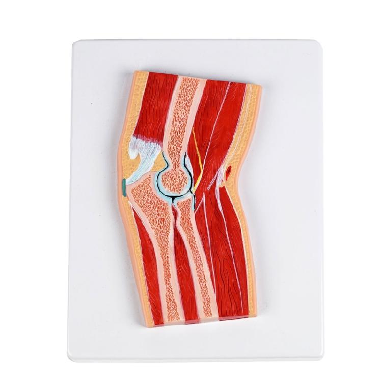 

Arm Elbow Joint Sectional Anatomy Model With Detailed Muscles and Ligaments For Classroom Demonstration Anatomy Study 1