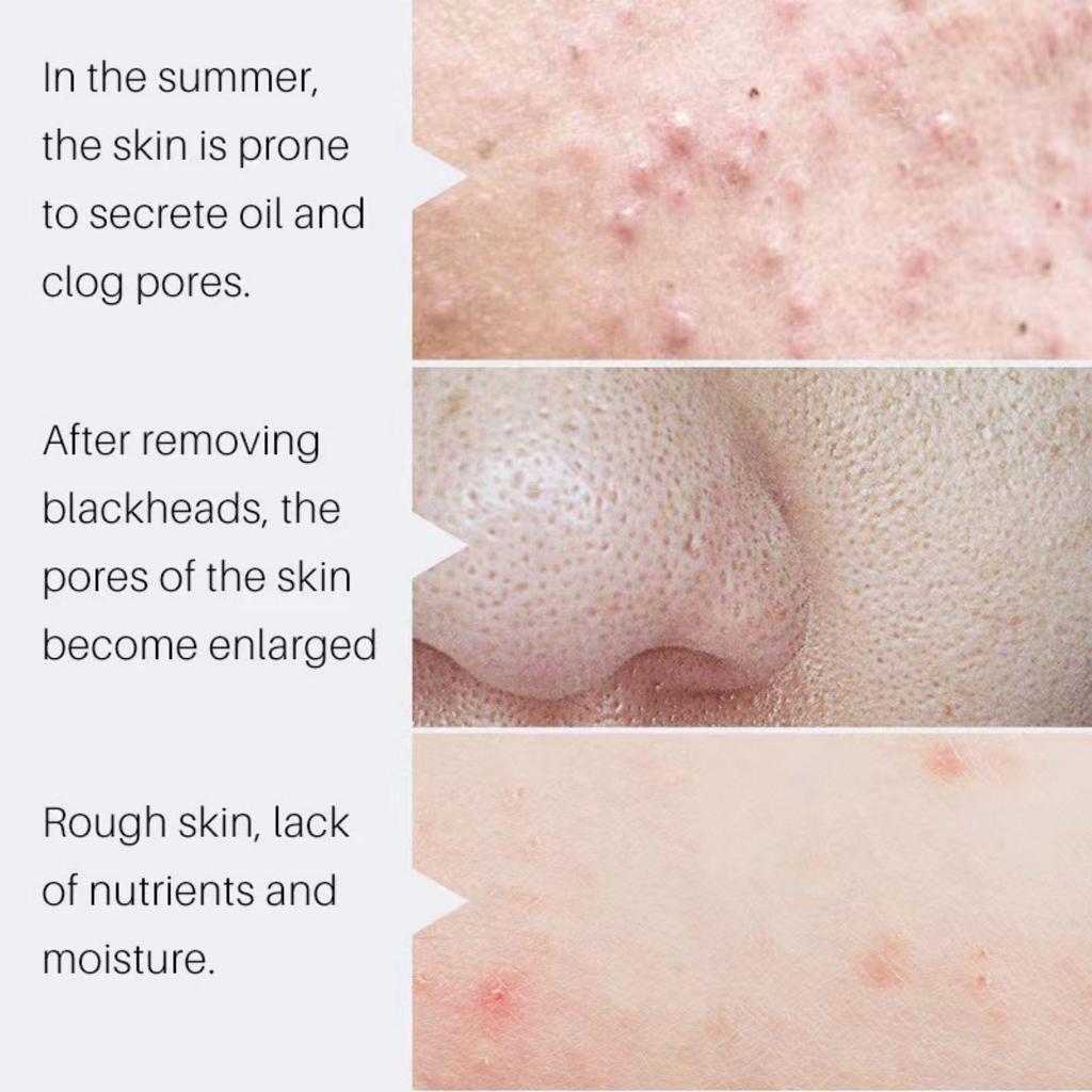 Soothes Dry Skin, Improves Elasticity, Unclogs Tightens Pores, Smooth Wrinkles