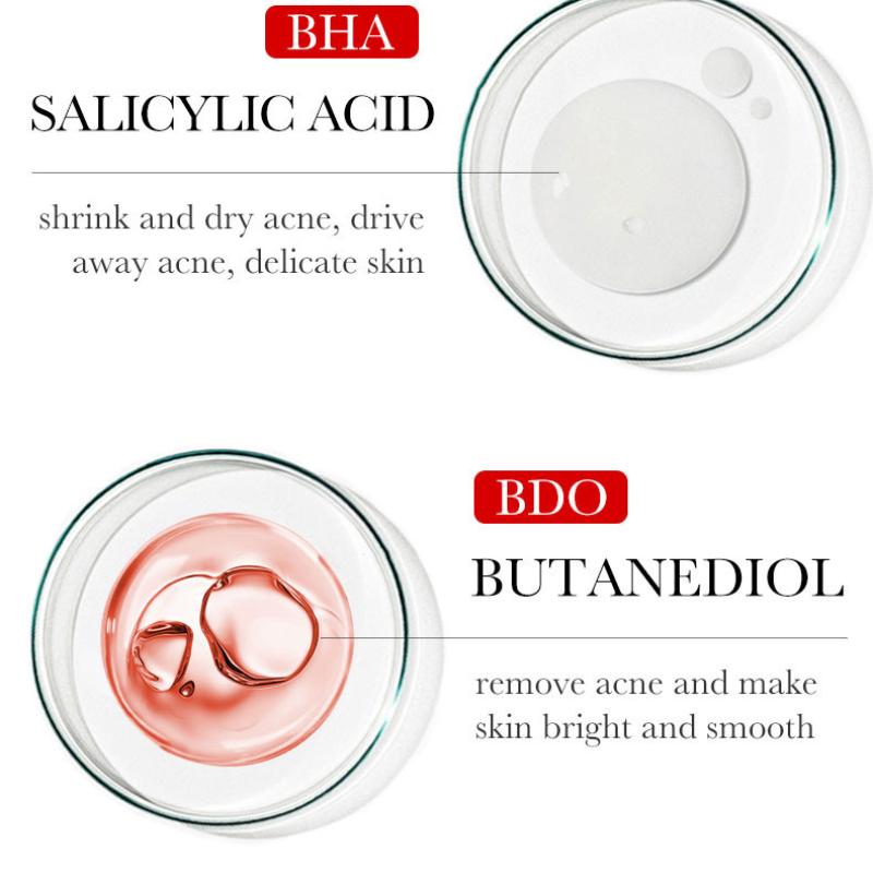 Acne Serum SADOER Fruit Acid Dilutes Acne Marks, Hydrates and Moisturizes