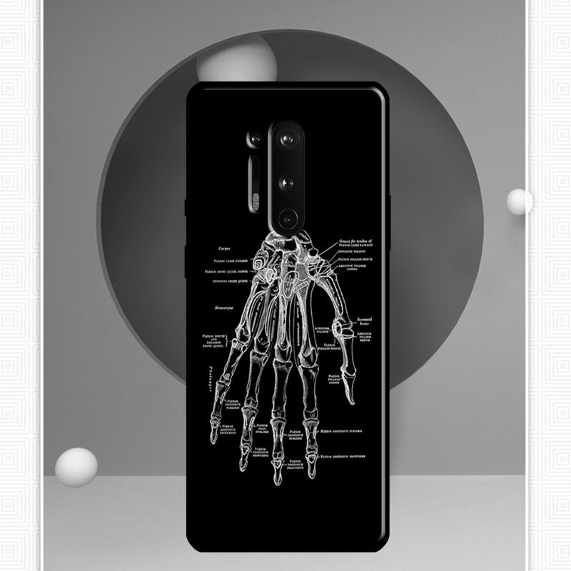 

Медицинский чехол для человеческих органов и мозга для OnePlus 11 10 9 Pro 8T 9RT 10T Ace OnePlus Nord N10 N100 N20 2T CE 2 Lite Cover OnePlus Nord