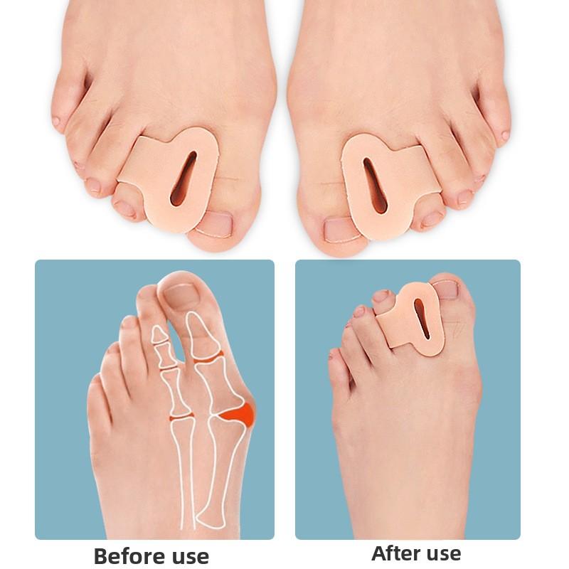 Thumb Valgus, Toe Splitter, Solaris Thickening, Shock Absorption, Massage Forefoot, Arch Position, Big Foot Bone, Foot Clipping Orthosis