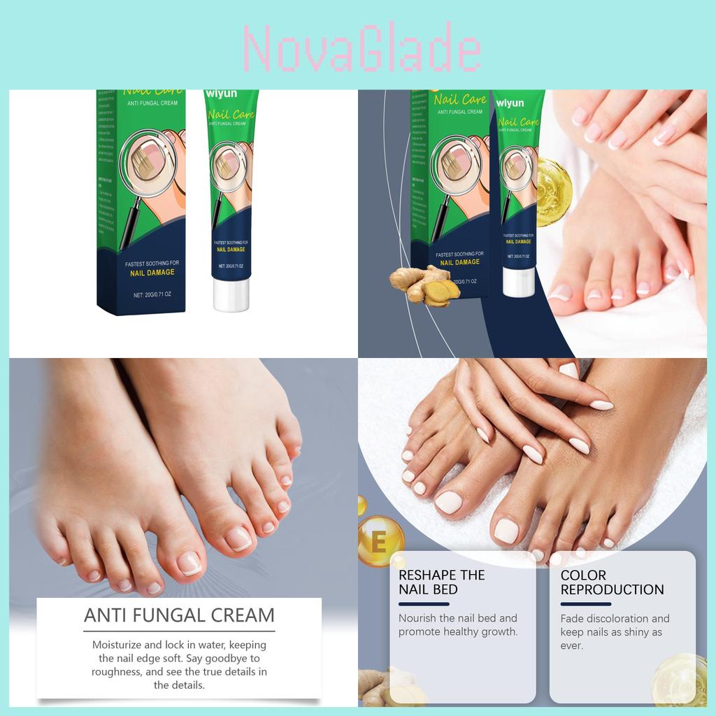 Nourishing Wiyun Nail Care Repair Cream For Glossy Shine And Comforting Relief