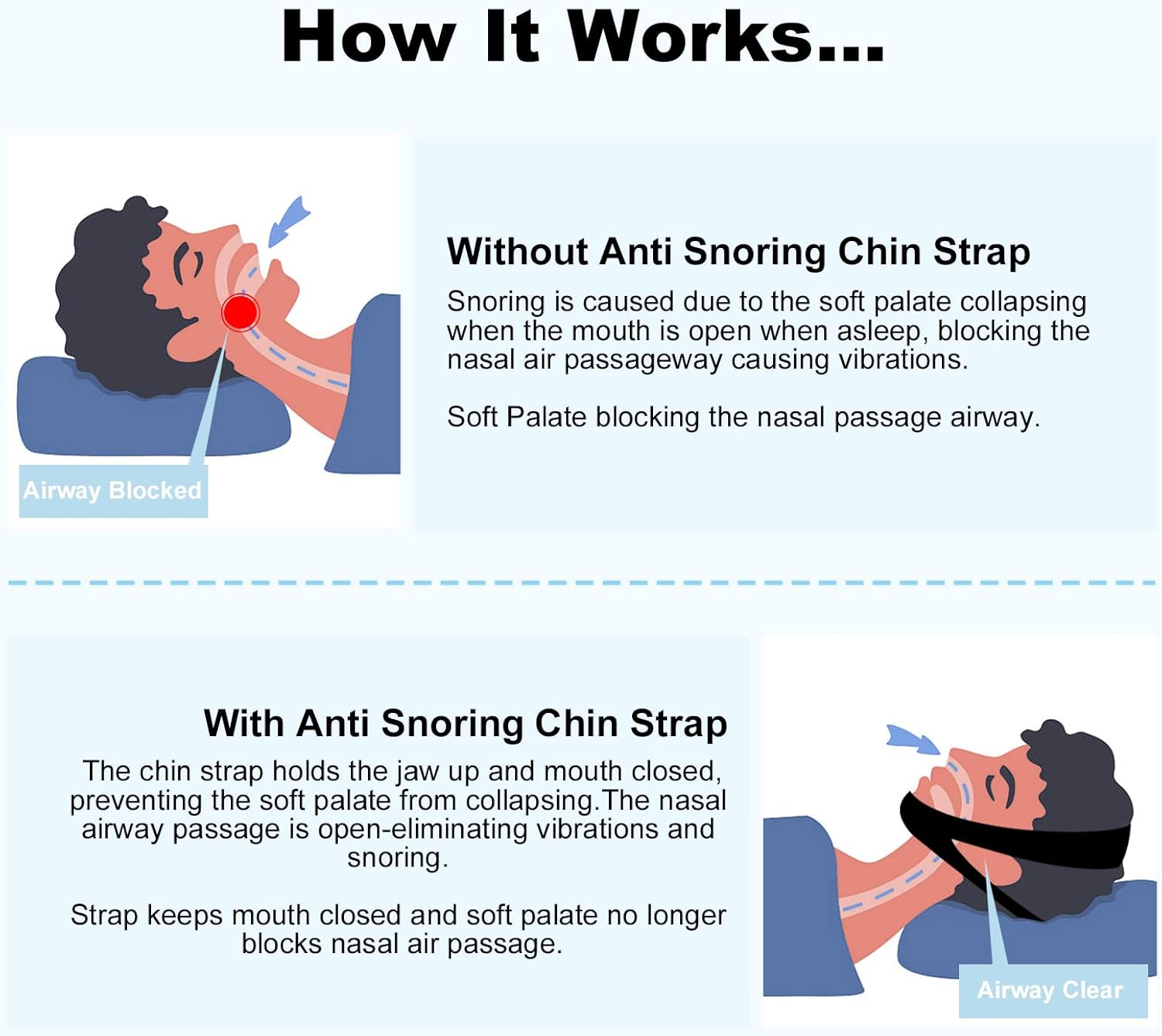 Устройства для борьбы с храпом — фото 5