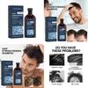East Moon Men's Shampoo Deep Cleansing Nourishing Roots Anti Hair Loss Strengthening And Thickening Formula 100ml
