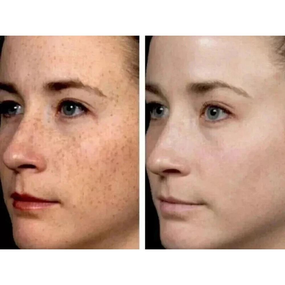 Face Serum with Tranexamic Acid and Niacinamide – Brightening, Hydrating & Firming Care for Even Skin Tone (30ml) Skin Care Serum Restoration