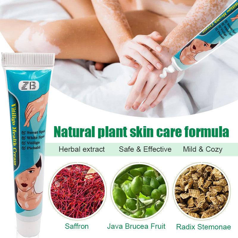 ZB Powerful Cream Treatment for Vitiligo and Skin Discoloration Reduce White Spots, Improve Skin Pigmentation