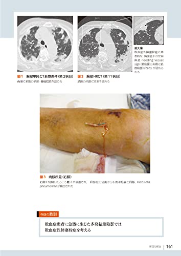Diagnostic Imaging Dojo Updated Edition <Chest Edition>