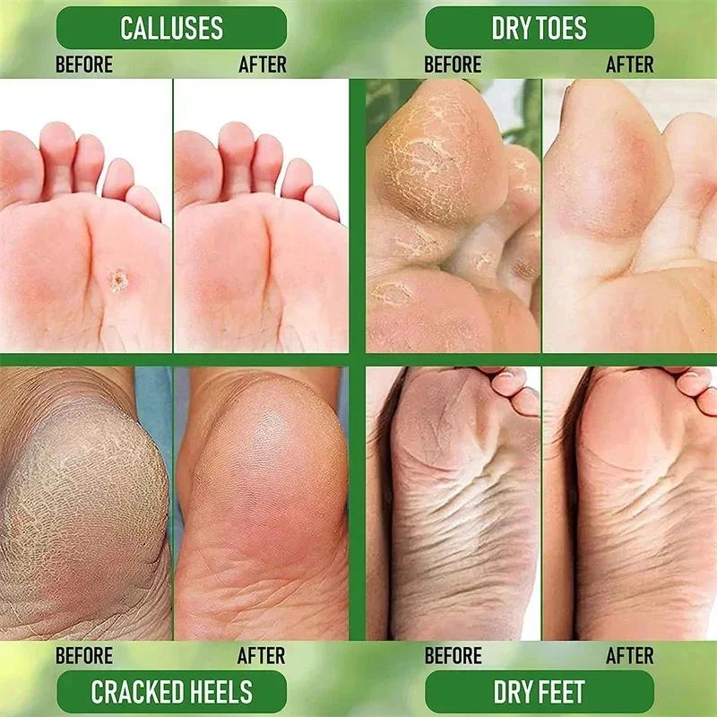 Crema Piedi Antifessure alle Erbe Prodotti Riparatori per Talloni Screpolati Esfoliazione Rimozione Pelle Morta Ammorbidimento Idratazione Cura della Pelle Liscia