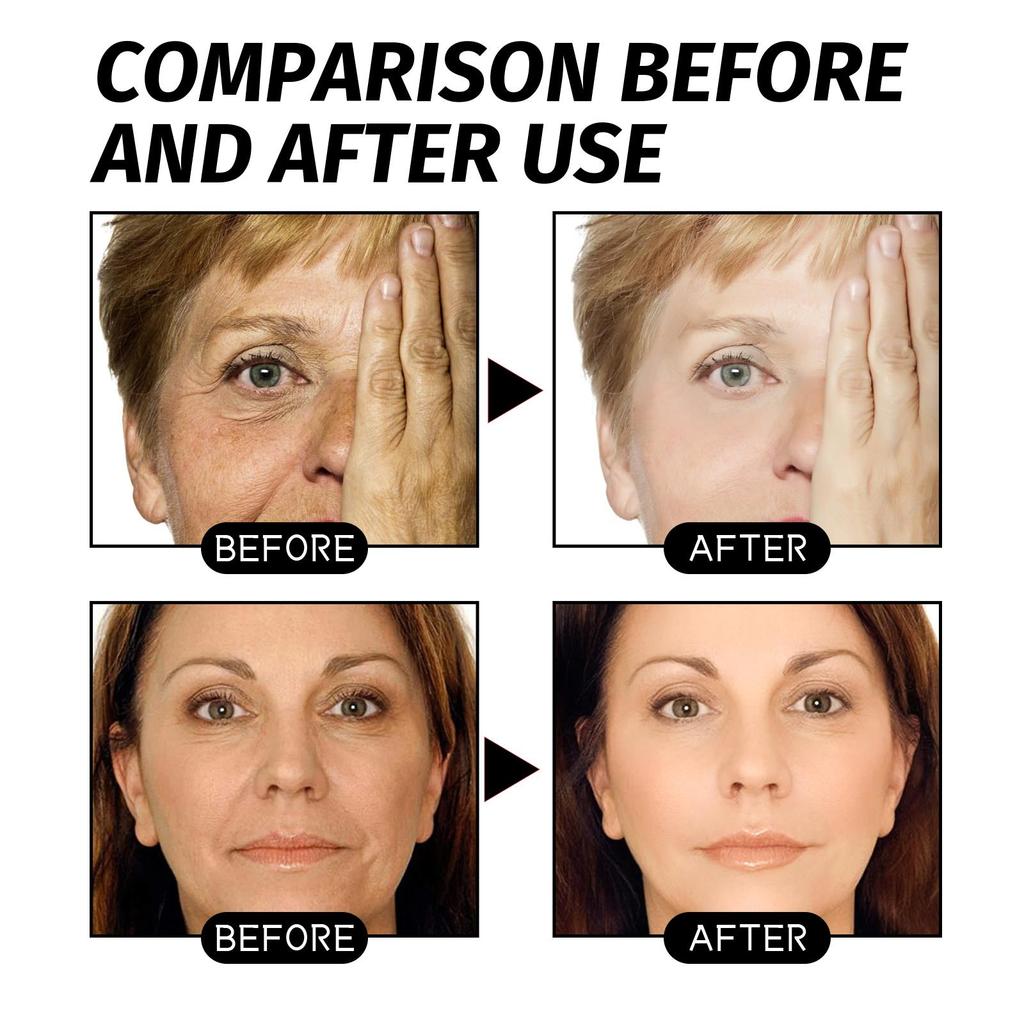 EELHOE Retinol Schlangengift Goldmaske Reinigung Haut Porenverfeinerung Aufhellung Verjüngung Feuchtigkeitsspendende Maske