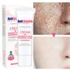 Whitening Freckle Cream Remove Dark Spots Melanin Melasma Brighten Face Cream Pigmentation Anti-Aging Skin Care Cosmetics