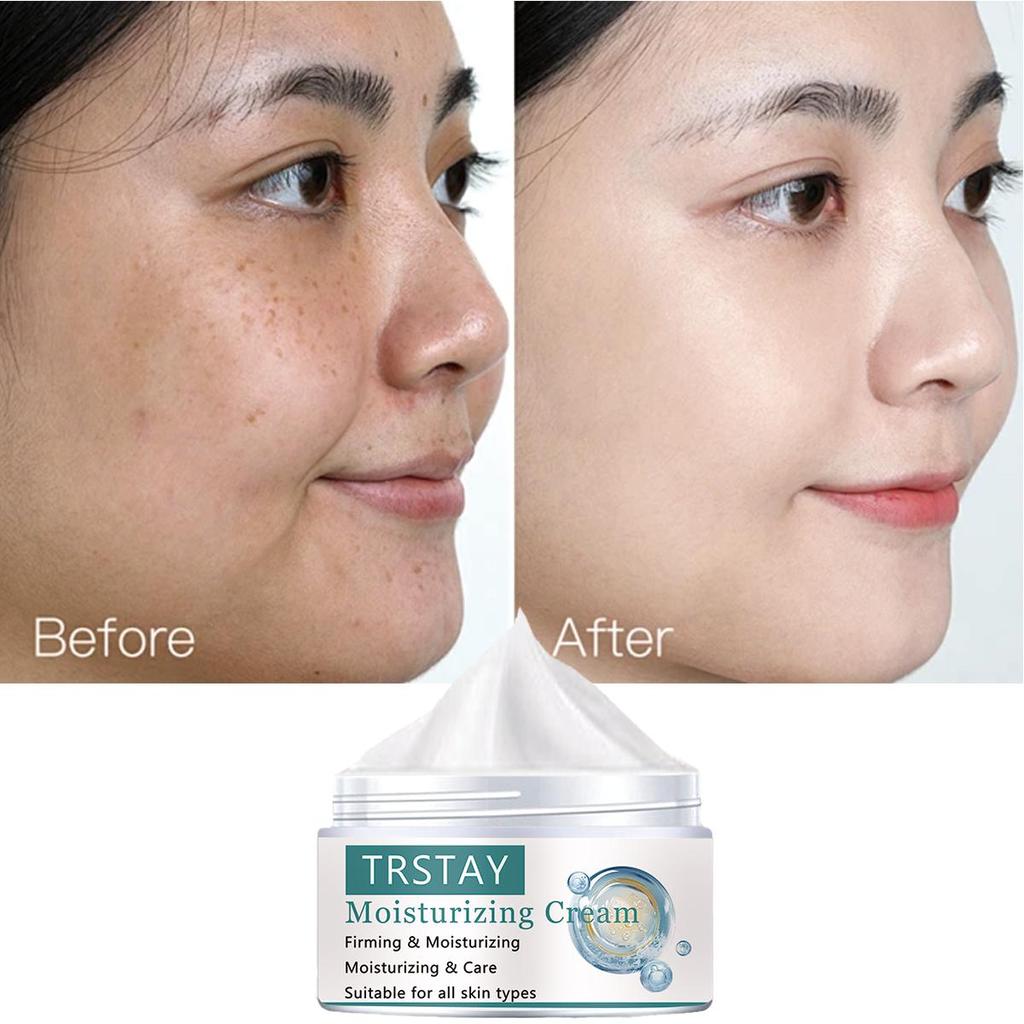 Whitening and Blacking Skincare Cream Nourishes the Skin, Evenly Brightens the Complexion, Replenishes Moisture, and Moisturizes the Skin