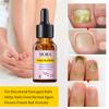 Finger and Toe Strengthening Repair Growth Essence - Nail Cuticle Care Essence