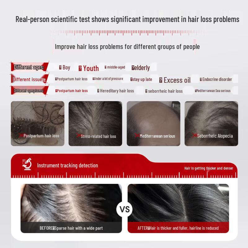 Three Master Hair Stylists Strong Anti-Dandruff & Anti-Hair Loss Shampoo Set