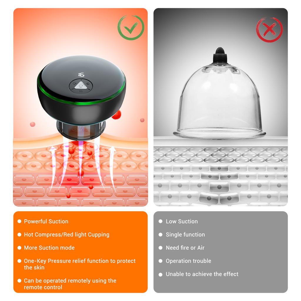 Electric Cupping Massage Machine Gua Sha Vacuum Suction Cups Anti Cellulite Negative Pressure Body Scraping Cupping Massager