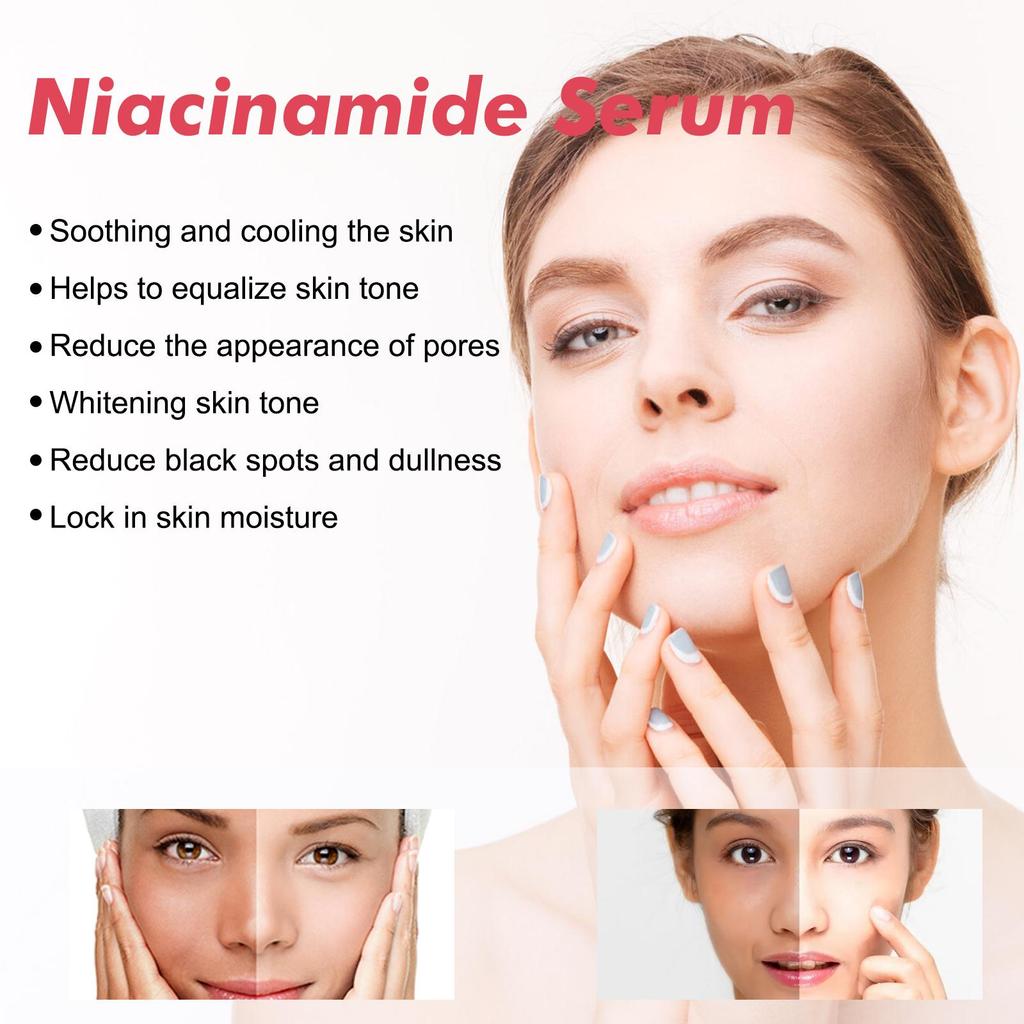 Hoygi Niacinamide Serum Firming & Hydrating Pores Fades Acne Marks & Fine Lines Brightens Skin & Reduces Dark Spots 30ml