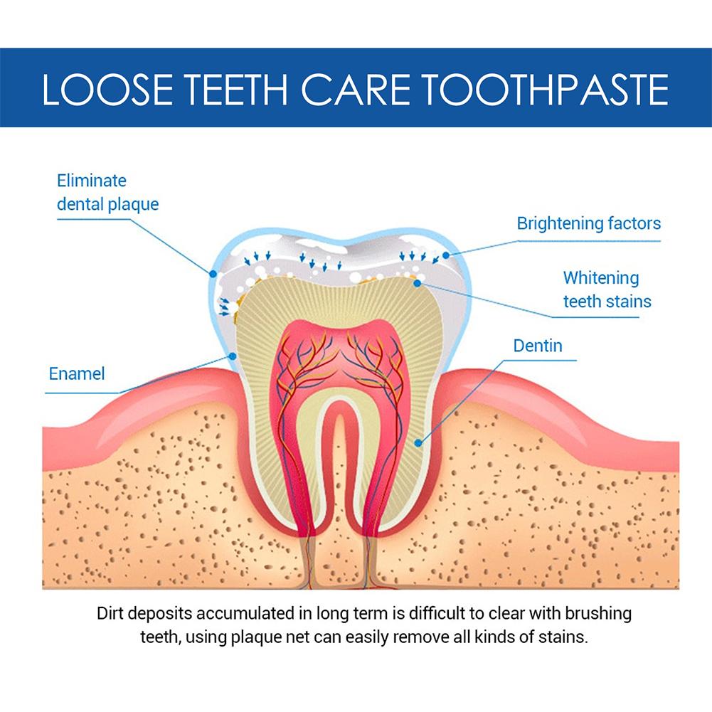 Quick Repair of Cavities Teeth Whitening Toothpaste Removal of Plaque Stains Decay Fresh Breath Repair Teeth Care Product 100g