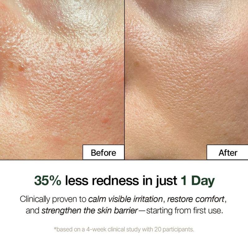 NDP - Cica Bio-Placenta Cream