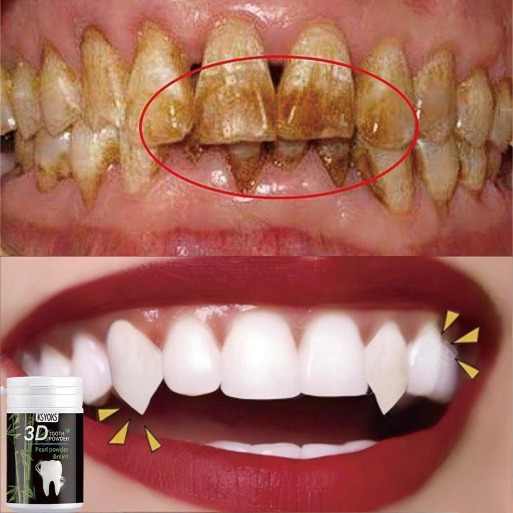 The surface of the teeth is shiny and the gaps between them are clean, so there is no need to worry about oral hygiene