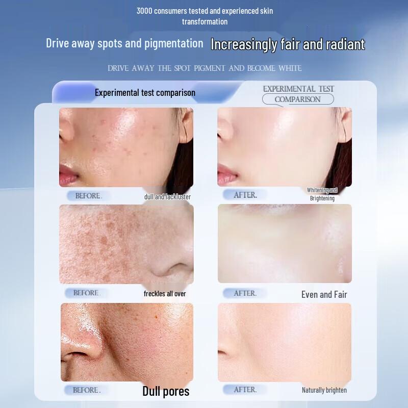 Yinqian 377 Whitening & Anti-Aging Sheet Mask