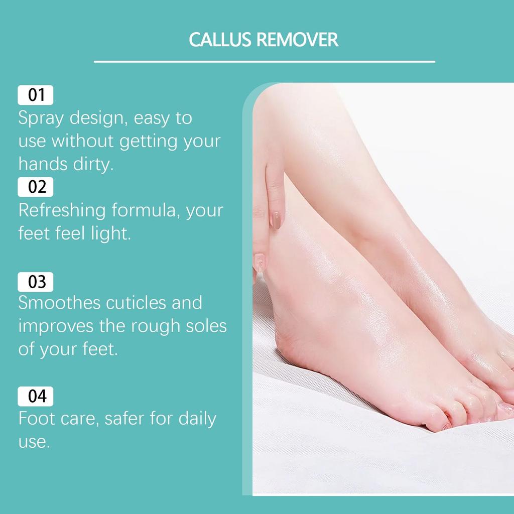 Foot Keratin Remover, Keratin Removal Spray, For Heel Calluses And Dead Skin Foot Care Spray,20ml