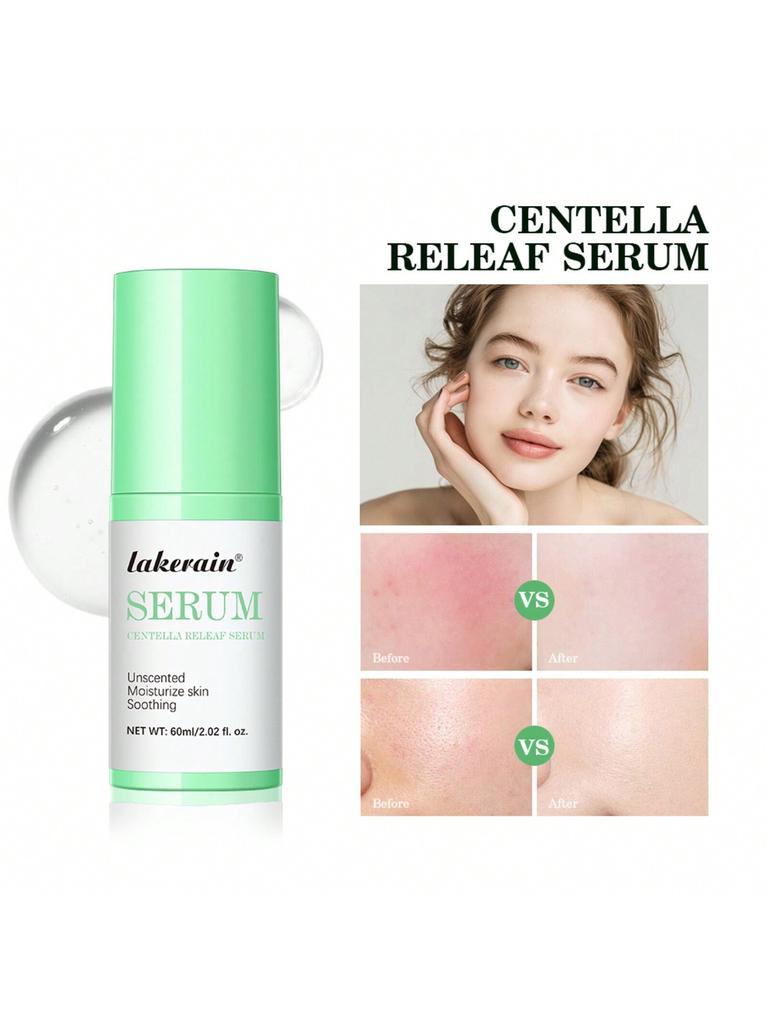 1Pc CENTELLA RELEAF SERUM With 60ml Fast Soothing Strengthens The Skin Barrier Gentle Skin Care Repa