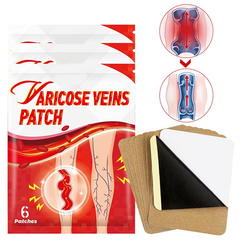 6 Patches/Pack Varicose Vein Patch External Plaster Shu Ning Patch Breathable Long-Lasting Soothing Spider Leg Vein Care Patches