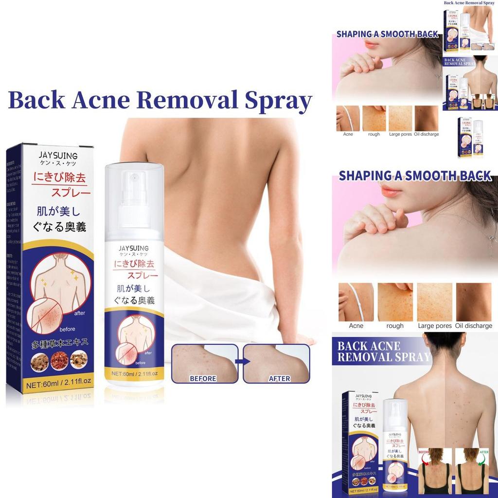 Jaysuing Back Care Spray For Fading Acne Marks And Smoothing Skin Texture