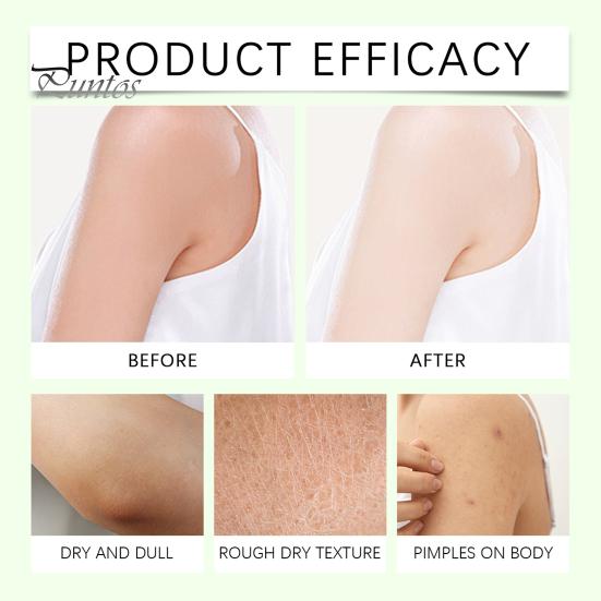 Magnesium Body Butter Cream for Neuropathy Relief 114g Shea Butter Moisturizer for Dry Skin Calming Smoothing Body Cream