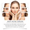 Niacinamide Anti-Acne Serum, Gentle Acne Treatment Serum for Face, Improve Blemishes & Moisturizing Repair Essence