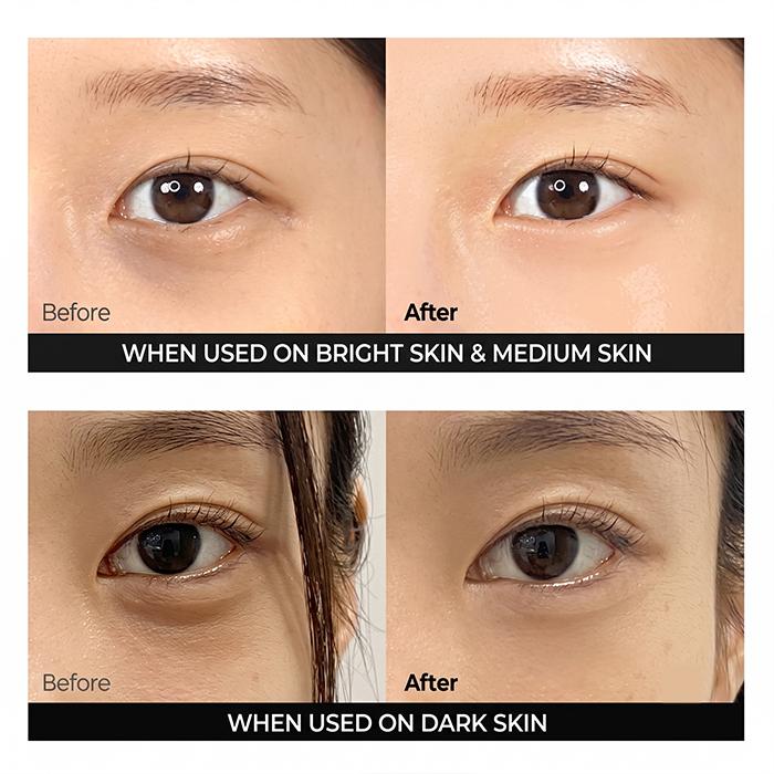 Dr.Melaxin Cemenrete Calcium Dark Spot Eye Cream 15g (3 Options)