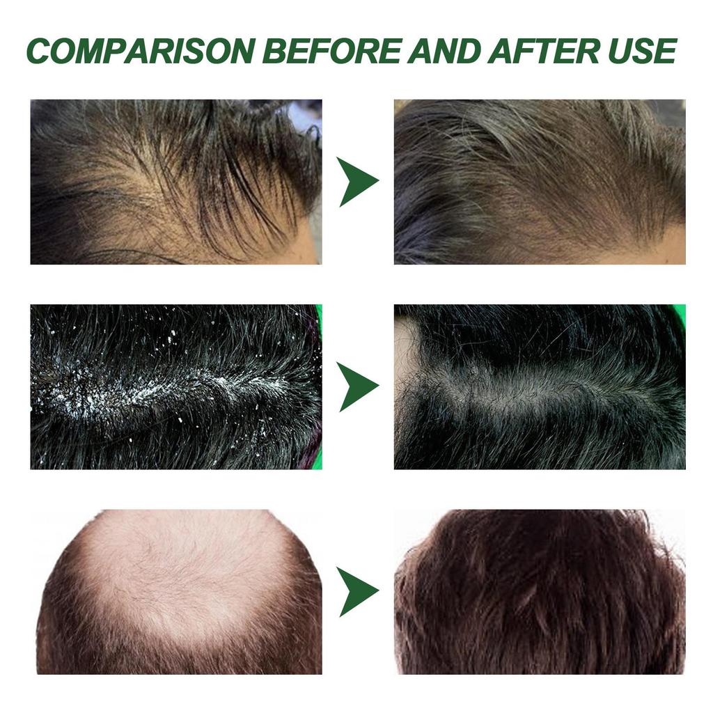 South Moon Hair Conditioning Spray Hair Nutritional Nourishing Massage Repair Conditioner Scalp Conditioner