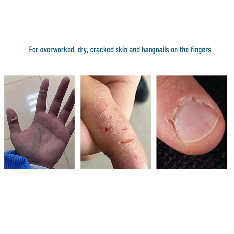 Yiwei Heel & Foot Cotton Patch: High Viscosity, Breathable, Anti-Crack Tape for Sensitive Skin.