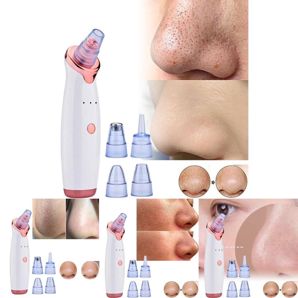 2020 Model Electric Blackhead Vacuum Cleaner For Deep Pore Cleansing And Care