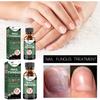 Eelhoe Nail Repair Liquid For Thick Toenails And Fungal Infections 50ml Ideal For Healthier Feet