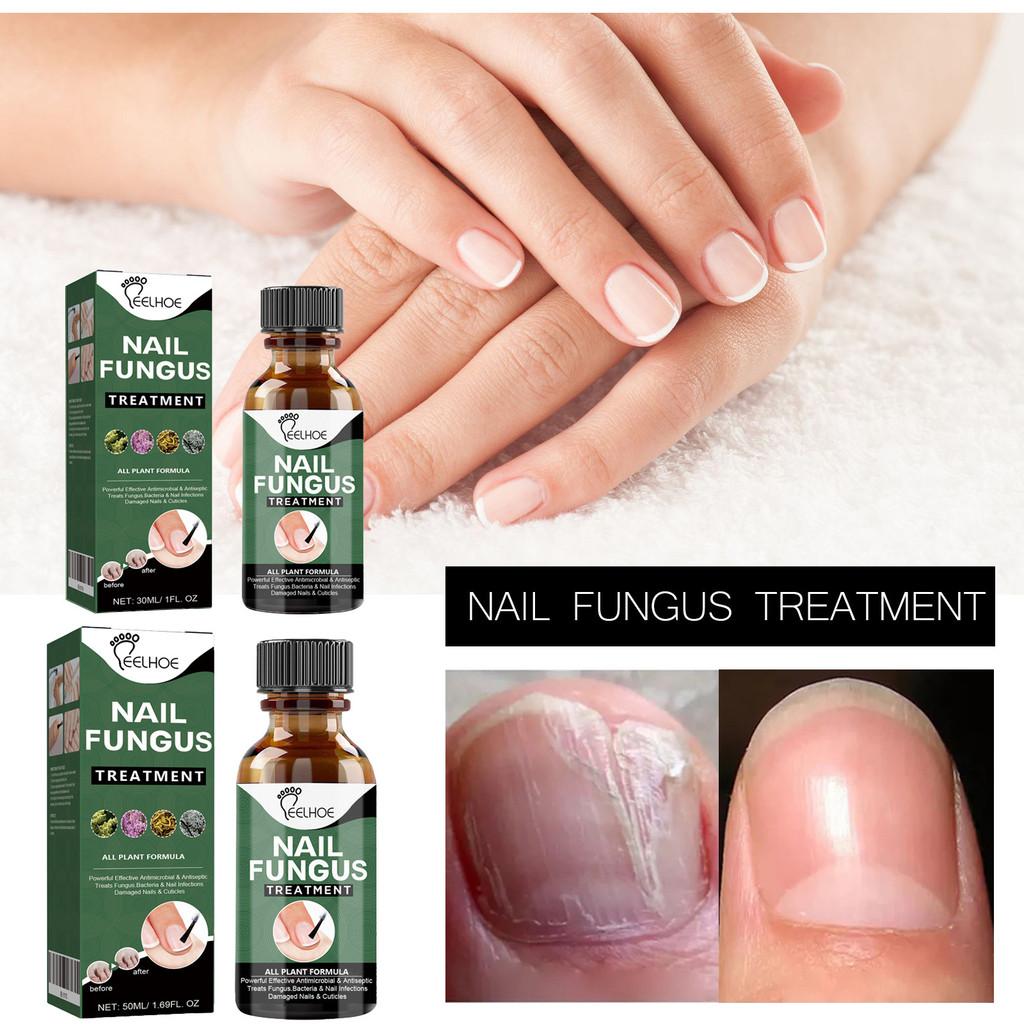 Eelhoe Nail Repair Liquid For Thick Toenails And Fungal Infections 50ml Ideal For Healthier Feet