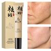 Whitening Freckle Cream Removes Melasma Yellow Spots Pigmentation Brightening Korean To Z2T2