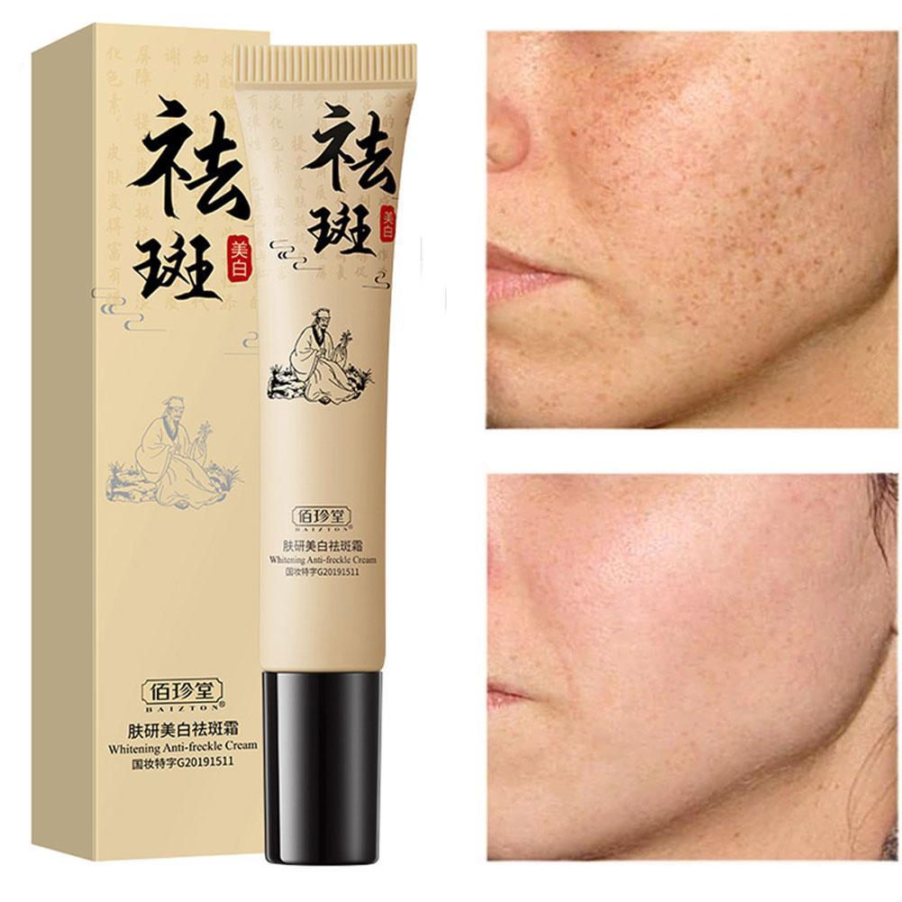 Whitening Freckle Cream Removes Melasma Yellow Spots Pigmentation Brightening Korean To Z2T2