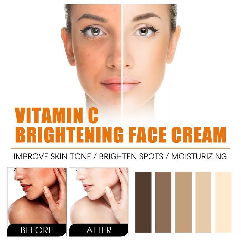 Vitamin C face cream moisturizes the face, desalinates acne marks and spots, and brightens, moisturizes and repairs the skin