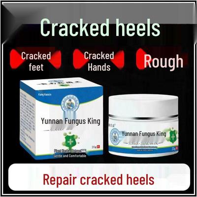 Genuine Yunnan Fungus King Heel & Hand Anti-Cracking Cream for Dry, Rough Skin