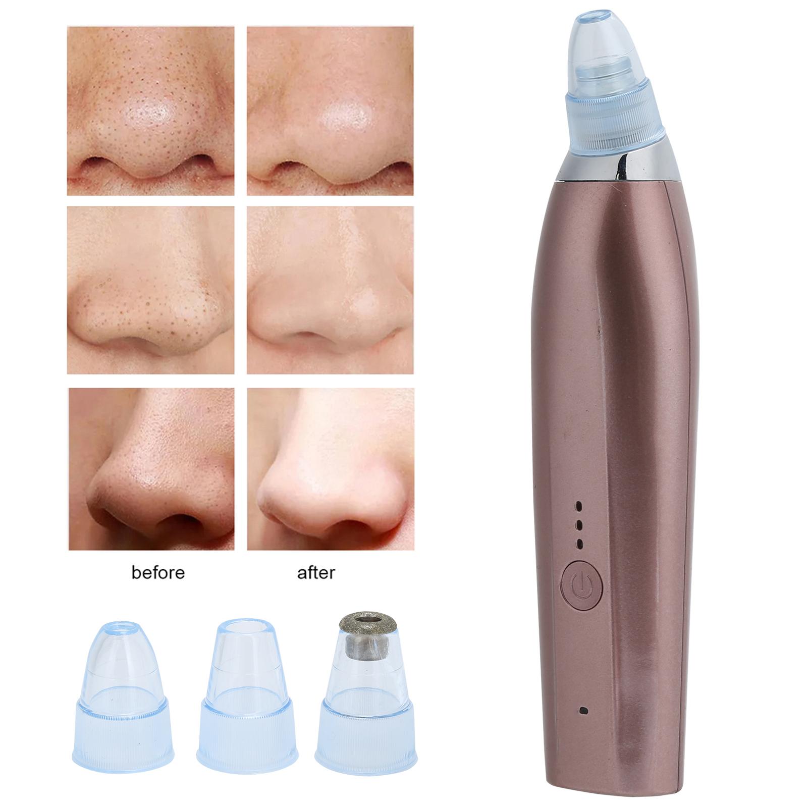 

Rechargble Electric Blackhd Removal NaMachine Vacuum Suction Face Pore Clner