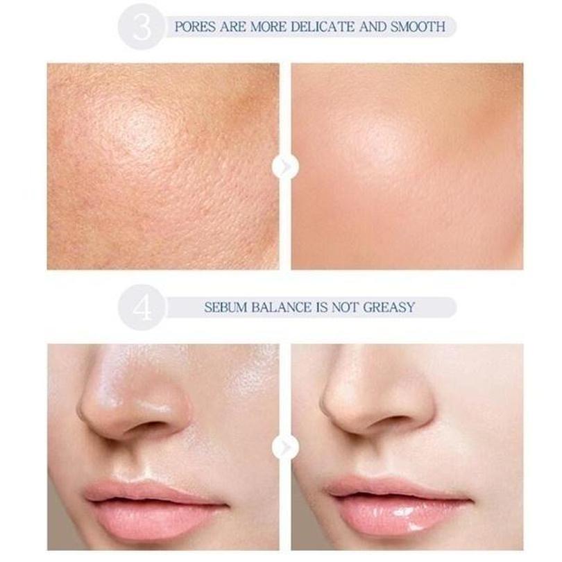 LAIKOU Hyaluronic Acid Essence Serum Moisturizing Reduce Acne Firming 17ml