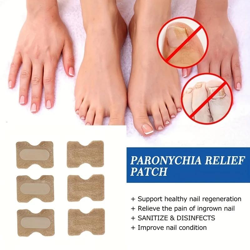 20Pcs Nail Correction Stickers Ingrown Toenail Corrector Patches Paronychia Treatment Recover Corrector Pedicure Tools